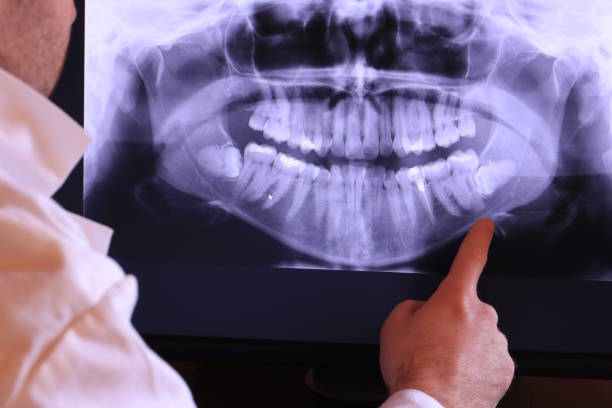 Best Walk-In Emergency Dentist in Coto De Za, CA