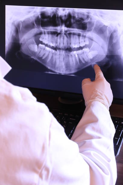 Best Emergency Wisdom Teeth Removal in Coto De Za, CA